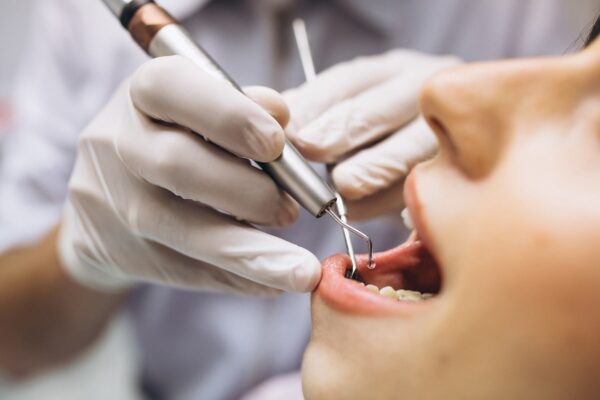 Deep Cleaning (Scaling and Root Planing) and Gum Lasering