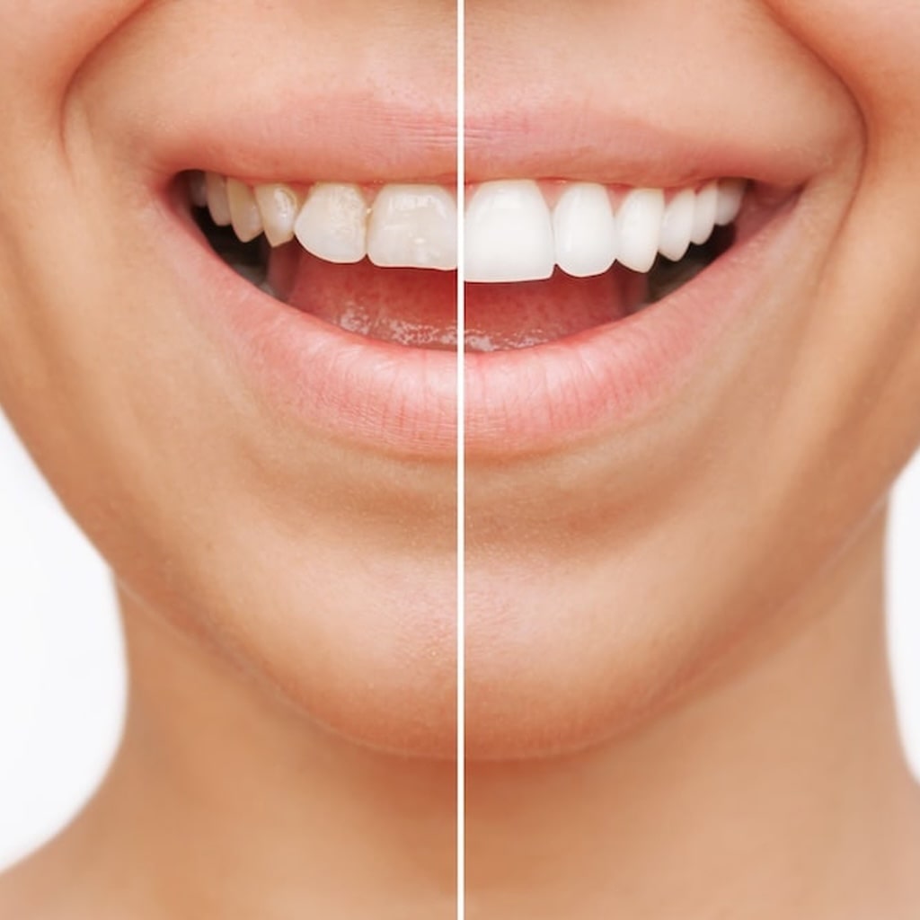 Smile Test Drive: Experience Your Future Smile with Confidence