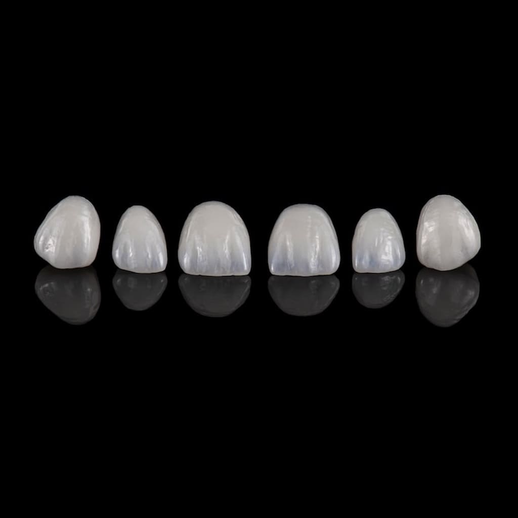 Dental Porcelain Veneers: Transforming Smiles with Precision and Beauty