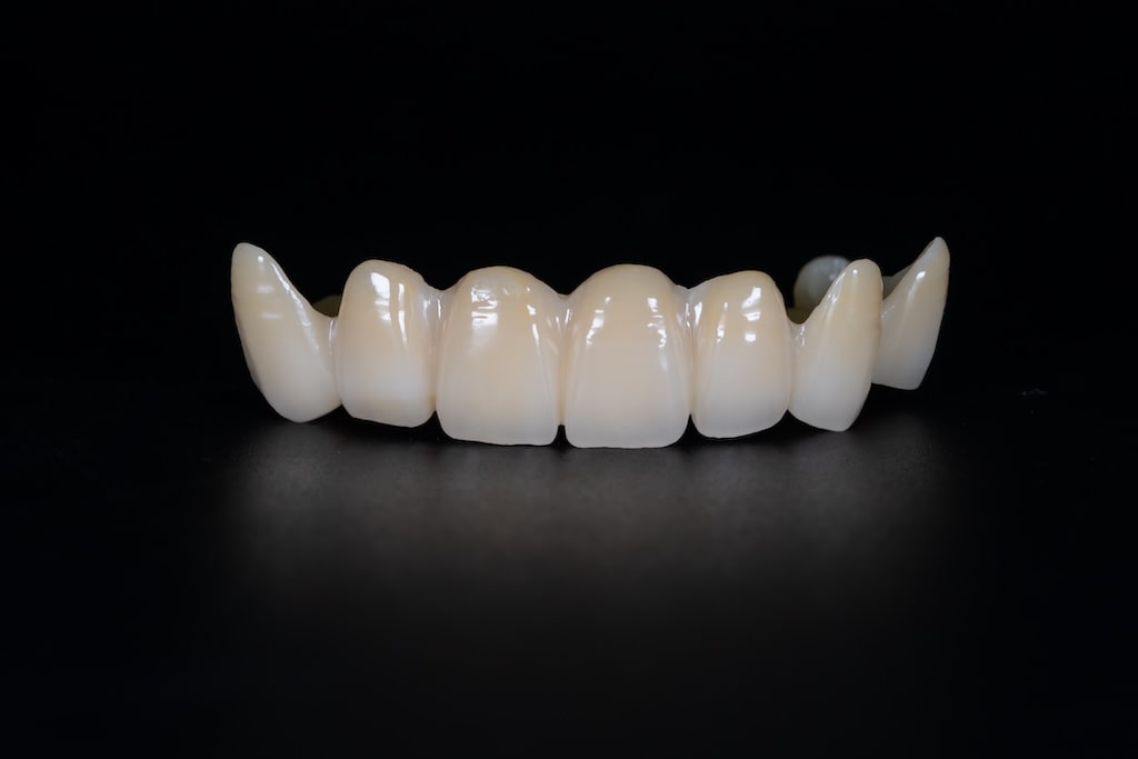 Smile Test Drive: Experience Your Future Smile with Confidence