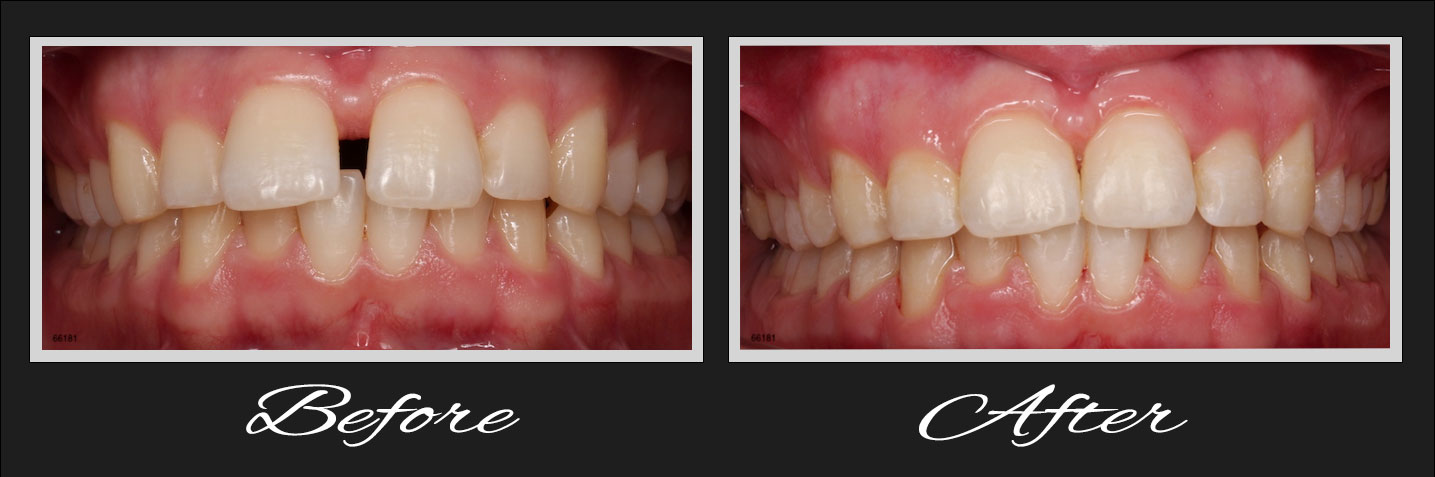 Computer-guided dental implant surgery and digital workflow visualization