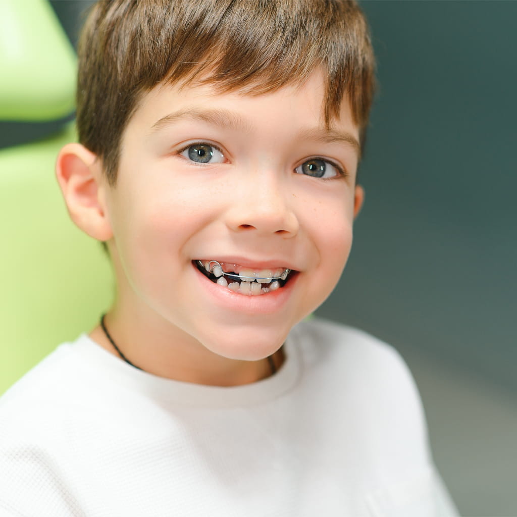 Braces for Children: When to Start and What Parents Should Know