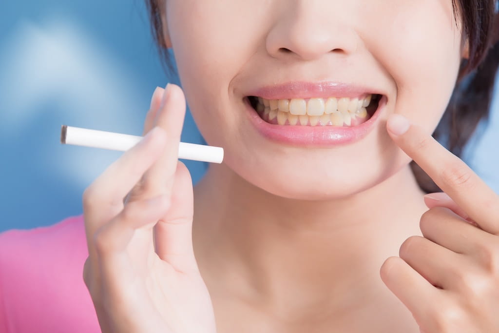 Can Smoking Affect Your Dental Implants?