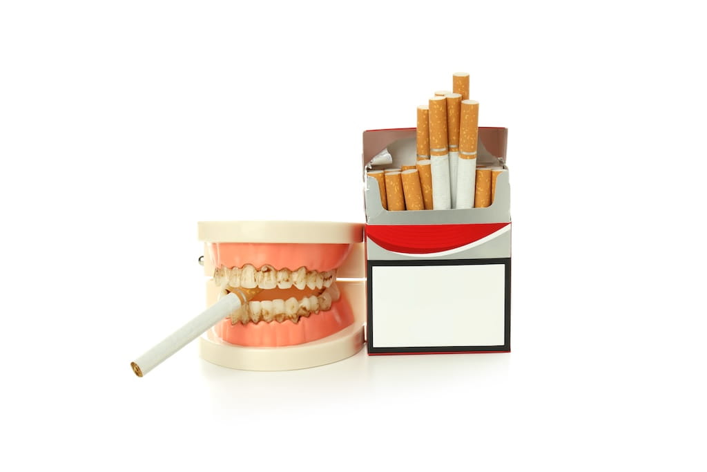 Can Smoking Affect Your Dental Implants?