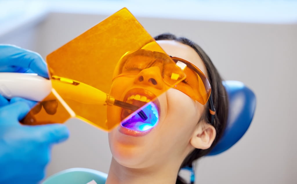 How Do Dental Fillings Impact Your Oral Health? Expert Insight from OC Perfect Smile in Laguna Hills