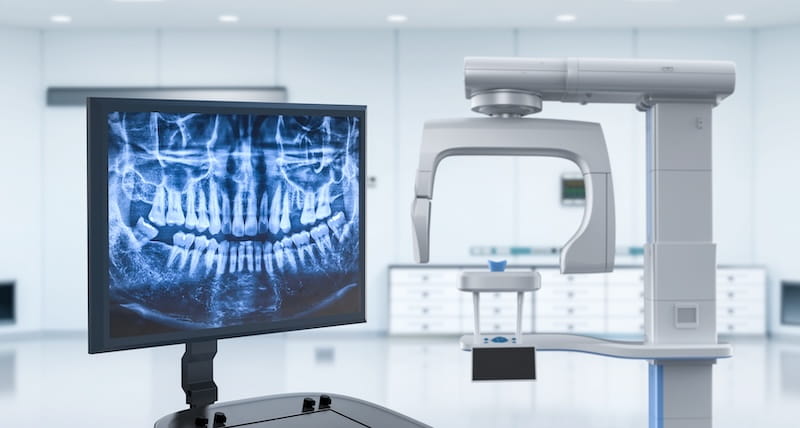 Are Dental X Rays Harmful to the Body? Understanding the Facts About Dental Radiation