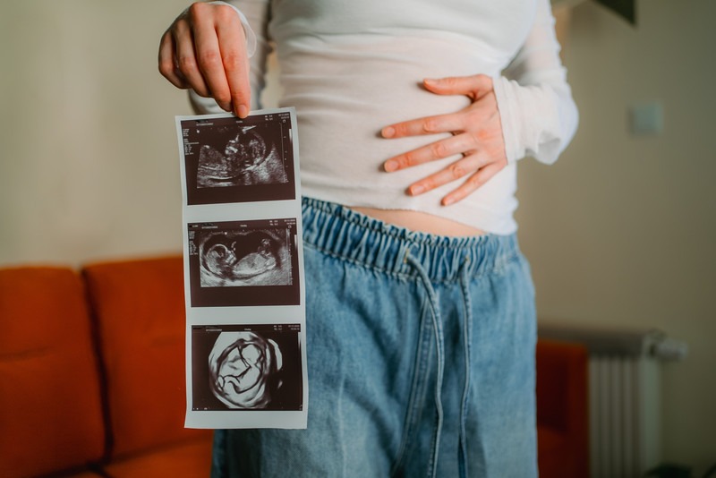 Dental Implants and Pregnancy: What Expecting Mothers Should Know - ocperfectsmiledental