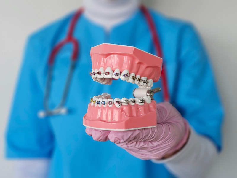Do You Really Need Teeth Pulled for Braces?