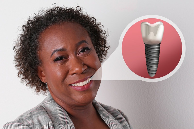 Why Do Dental Implants Fail and How Can You Avoid It?