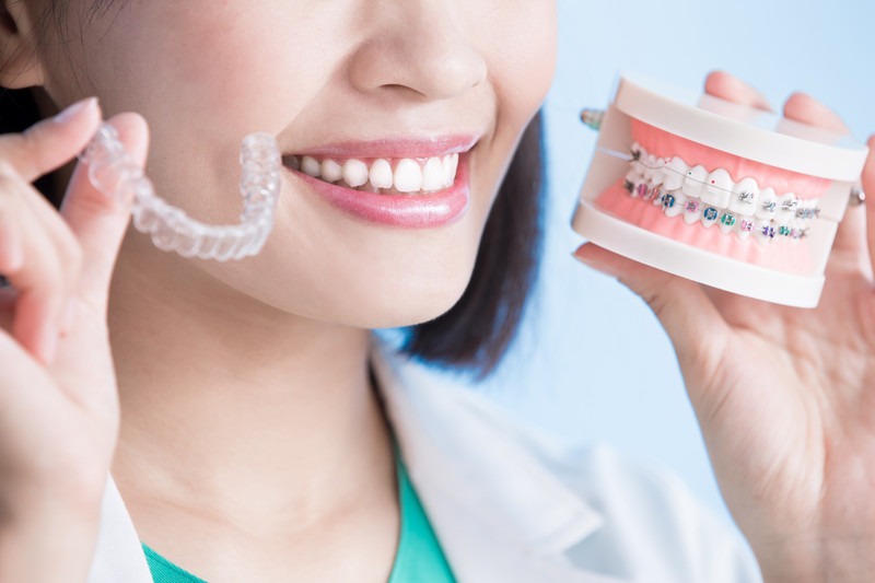 Are Clear Aligners Better Than Traditional Braces for Adults?