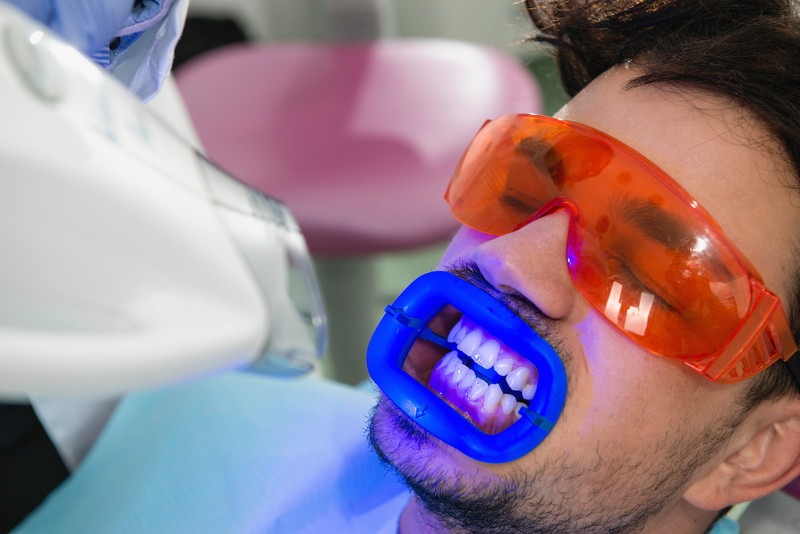 In-Office vs. At-Home Teeth Whitening: Which Option Is Best?