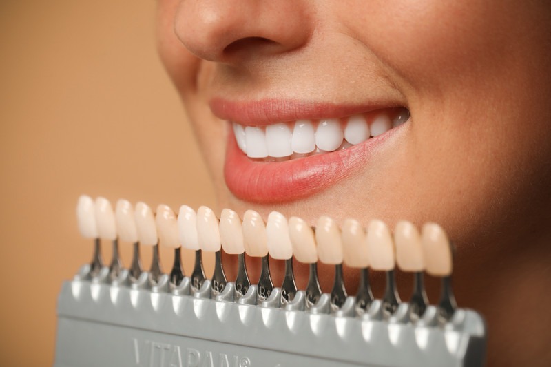 In-Office vs. At-Home Teeth Whitening: Which Option Is Best?